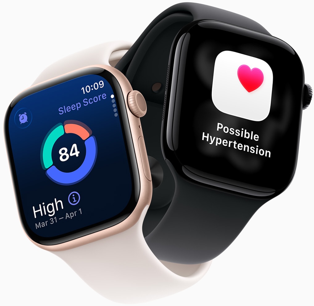 https://macdata-public.s3-eu-west-1.amazonaws.com/stuff/bilder/Apple-Watch-Series-11.jpg